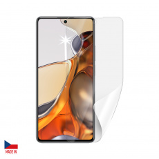 Screenshield XIAOMI 11T Pro folie na displej Screenshield XIAOMI 11T Pro folie na displej