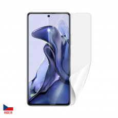 Screenshield XIAOMI 11T folie na displej Screenshield XIAOMI 11T folie na displej